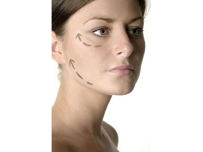 Facelift