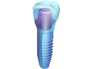 Implantáty ()