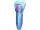 Implantáty ()